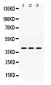 Anti-ADH1A Picoband Antibody